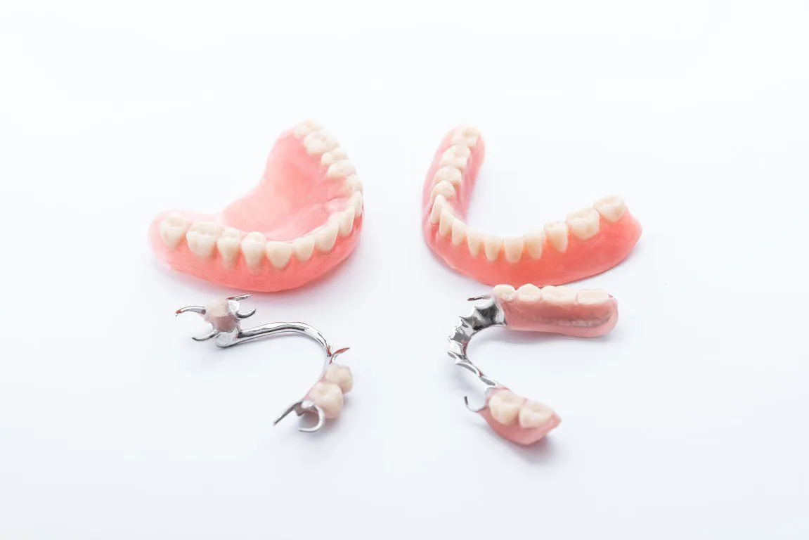 denture image, showing four different types of dentures, partial, full and more.