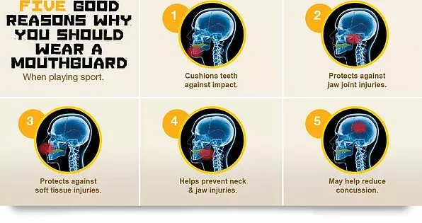 infographic sowing five reasons why you should wear a mouthguard when playing a sport.